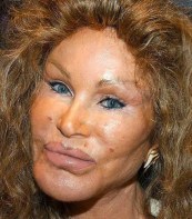 the-bride-of-wildenstein_8-reasons-to-avoid-cosmetic-surgery